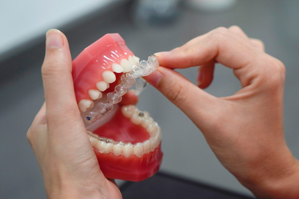 Top Benefits of Invisalign